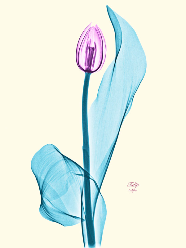 x-ray-5
